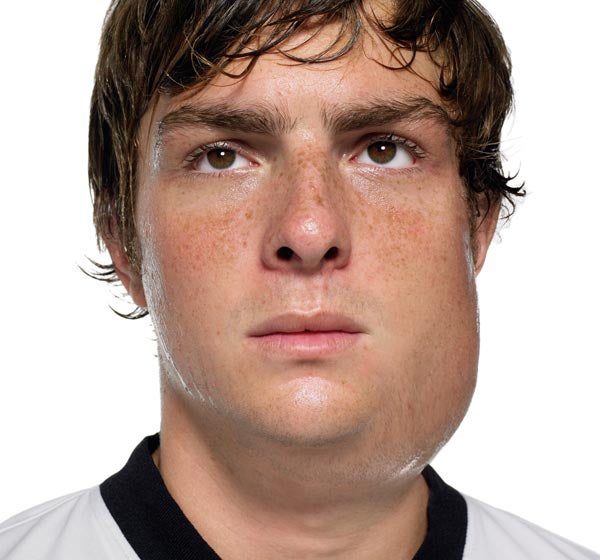 Mumps Effects