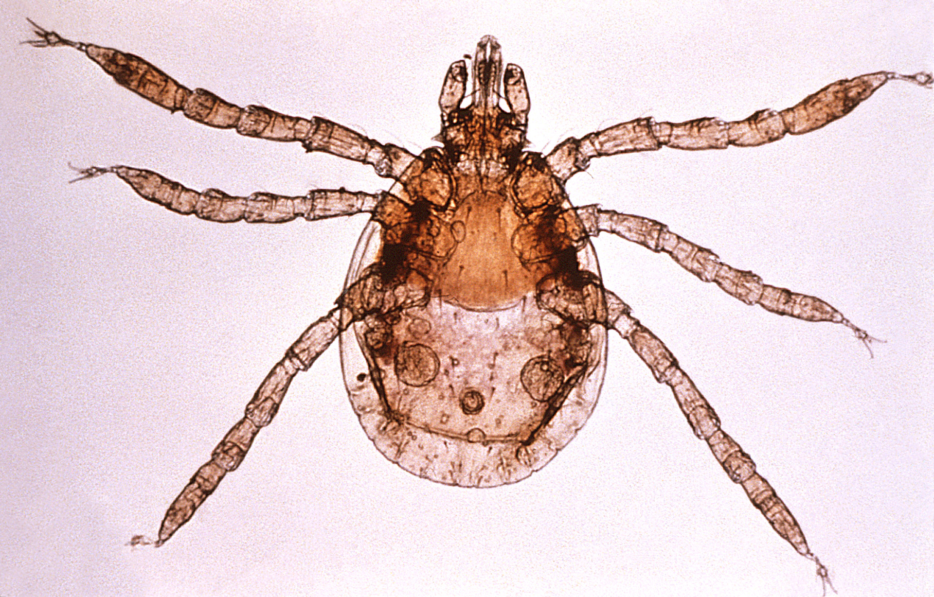 Tick-borne Encephalitis